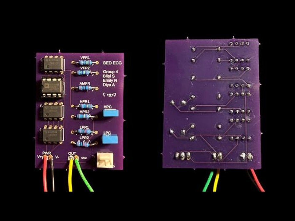 The purple ECG circuit board